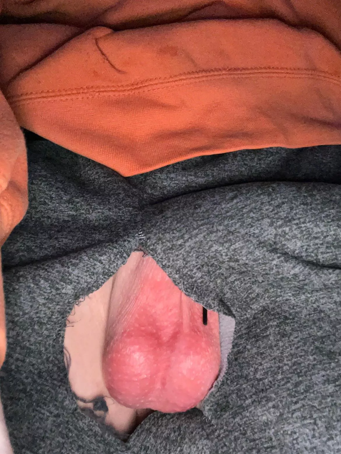 Full teen balls need drained, dm to help Full teen balls need drained, dm to help