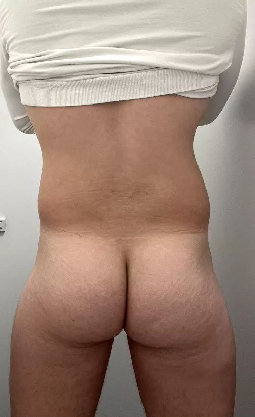 Getting fatβ¦