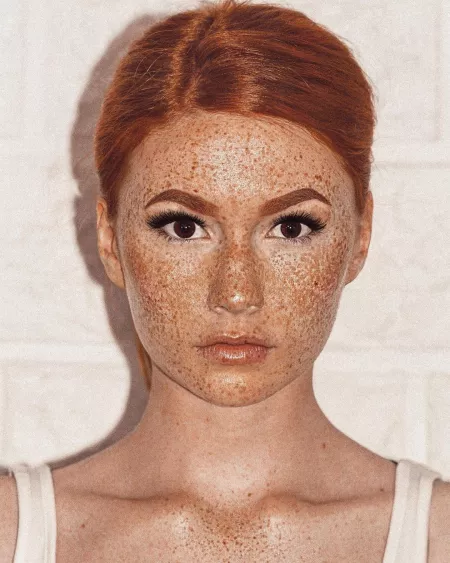 Ginger freckles 💘