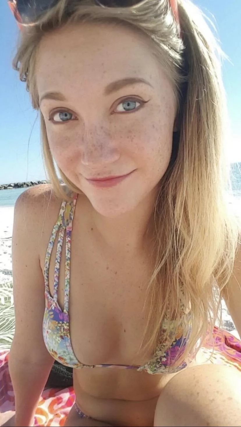 Teen Freckles