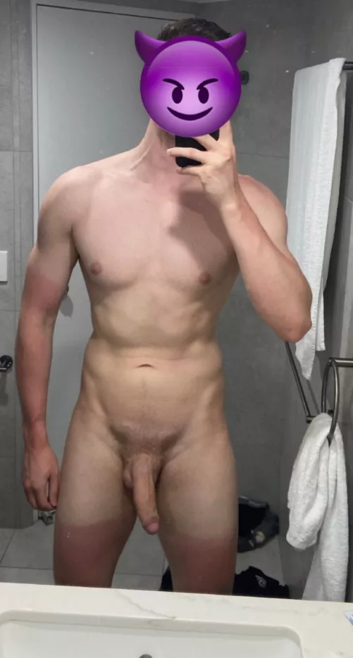 Got a bit burnt at the beach yesterday 😅