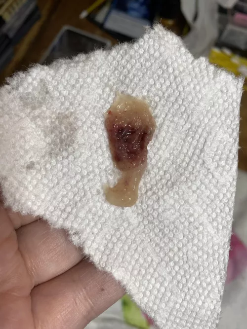 Got the Rona and good god, this god awful thing was stuck in my nasal passages for 4 days. Got it out today and I could finally breath!