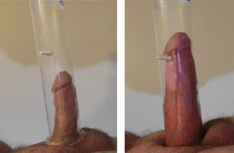 Growth