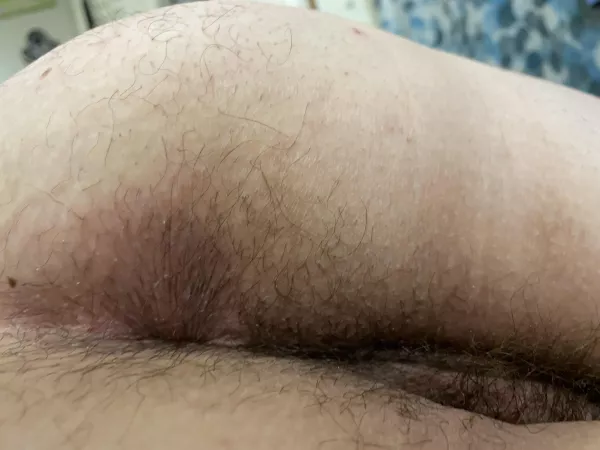 Hairy BBW ass 🍑🍑