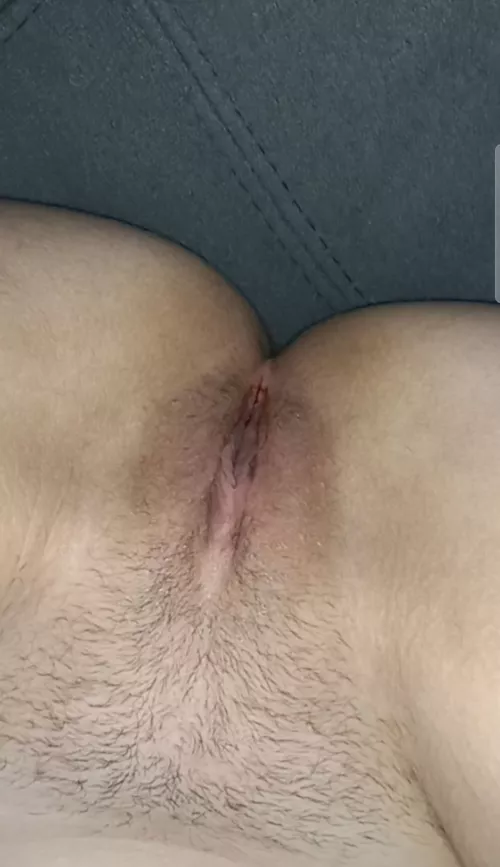Hairy Pussyโฅ๏ธ๐ฆ๐