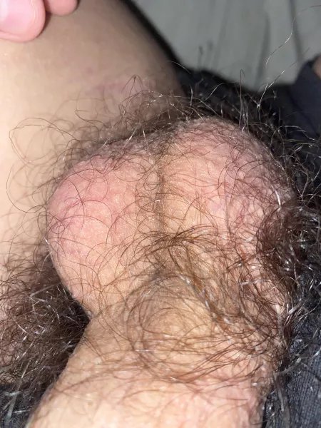 Hairy small balls ๐๐ Hairy small balls ๐๐