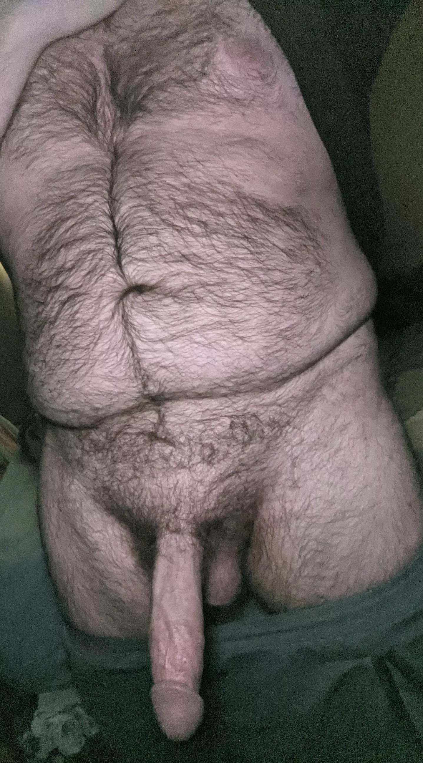 Hairy tummy
