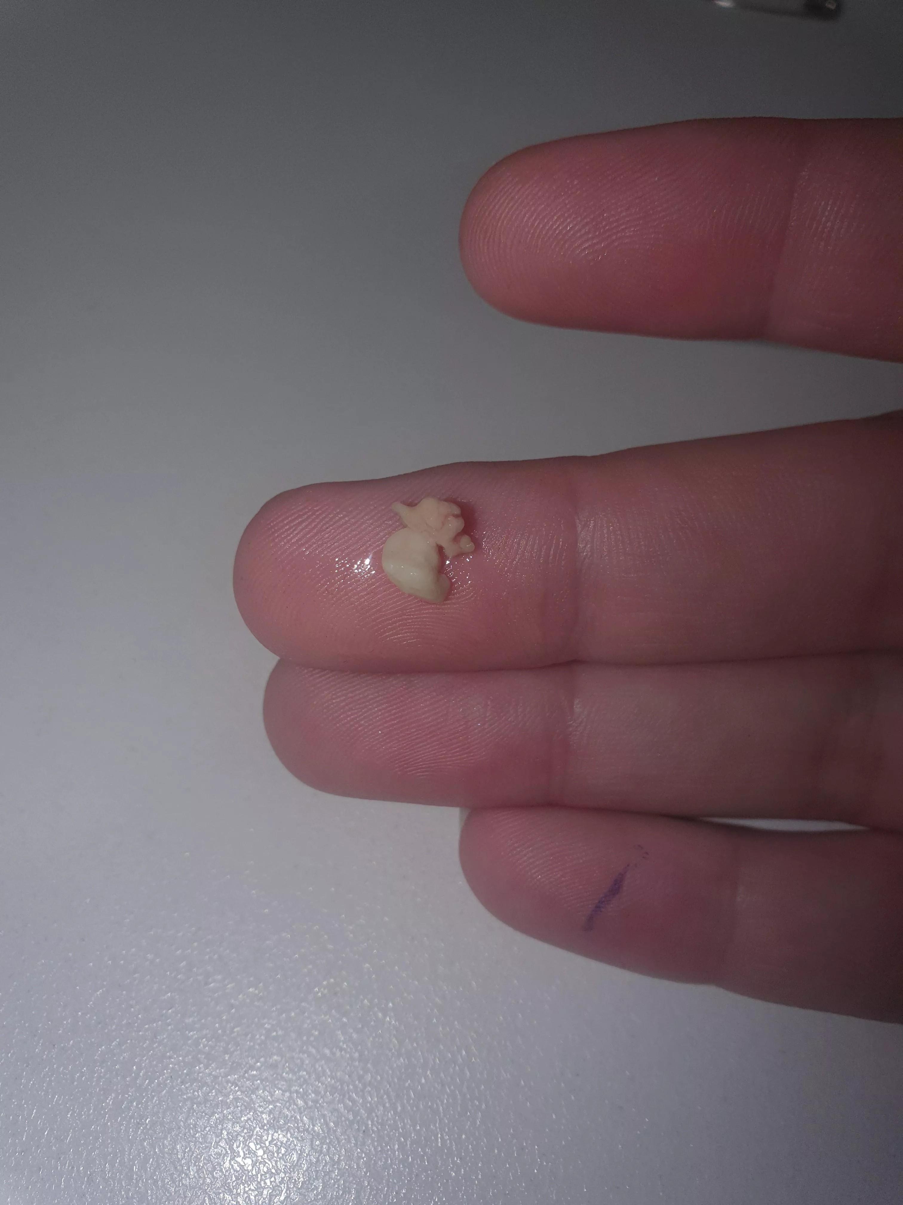 Have felt like there was a piece of popcorn in my throat all day, finally had a chance to check and this came out