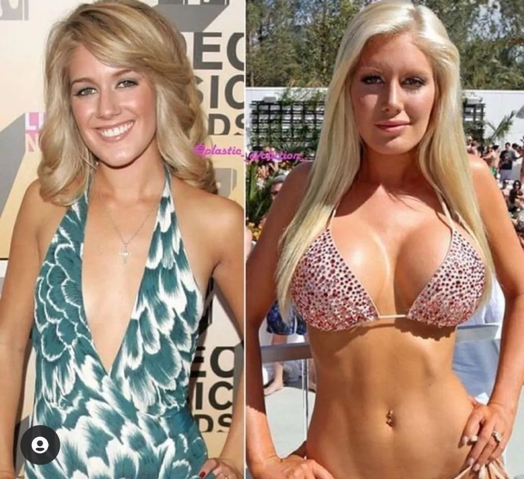 Красивая раздетая знаменитость Heidi Montag