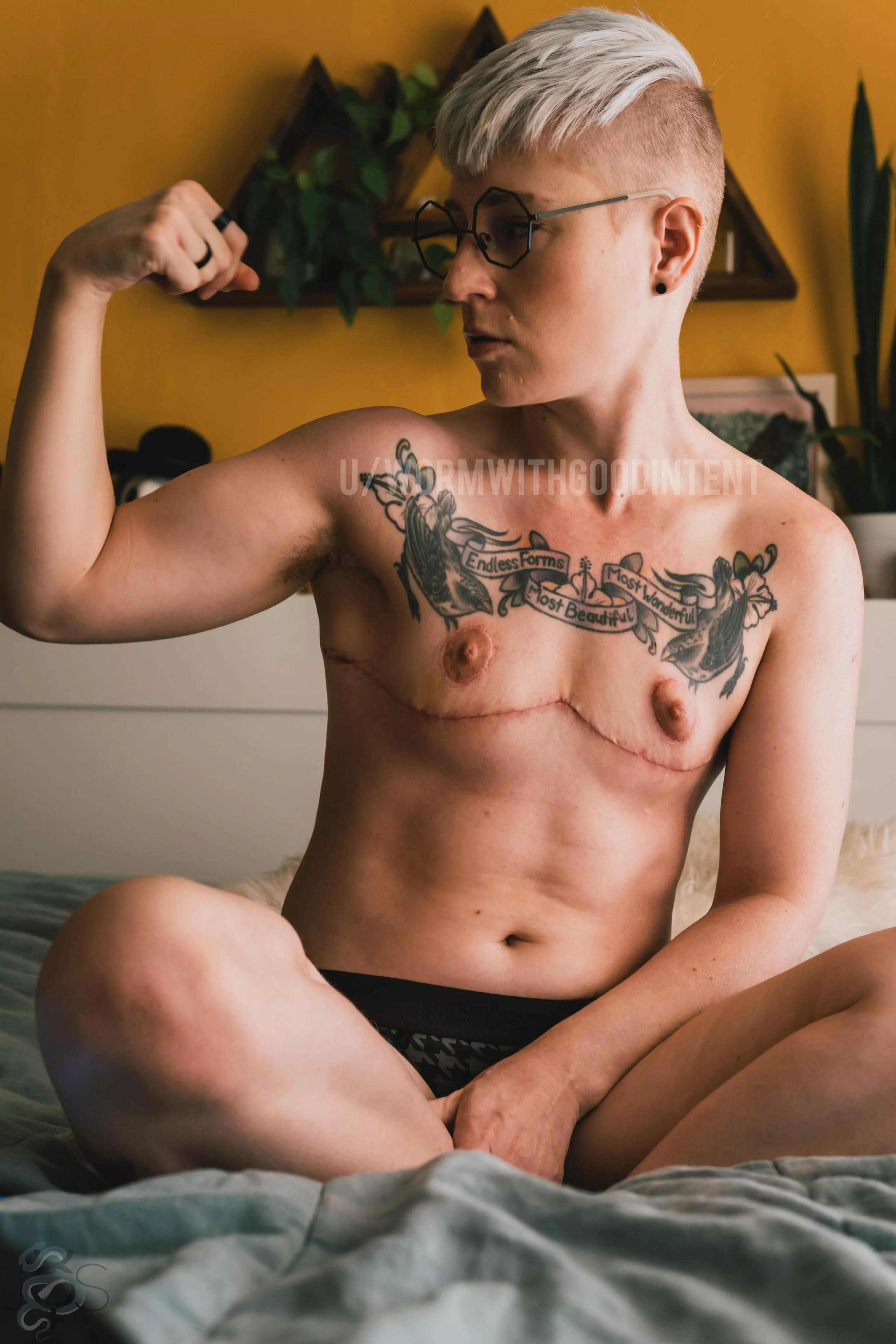 Hey r/bois. I got top surgery!!! Iβm officially part of the tiny tibbies gang. Do you still love me? π₯Ίππ»ππ» Hey r/bois. I got top surgery!!! Iβm officially part of the tiny tibbies gang. Do you still love me? π₯Ίππ»ππ»