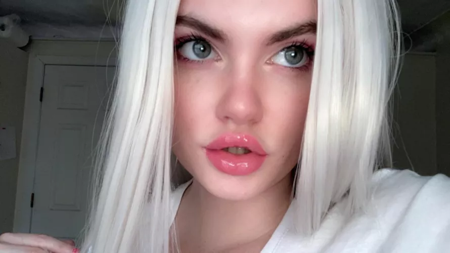 Hi i got more lip filler today! Will be getting it every monthish now and tits in May!