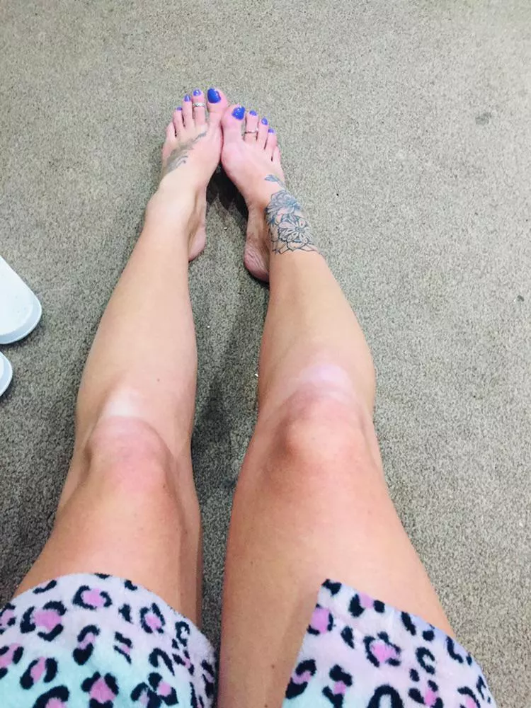 Hope you love my purple toes πππ Hope you love my purple toes πππ