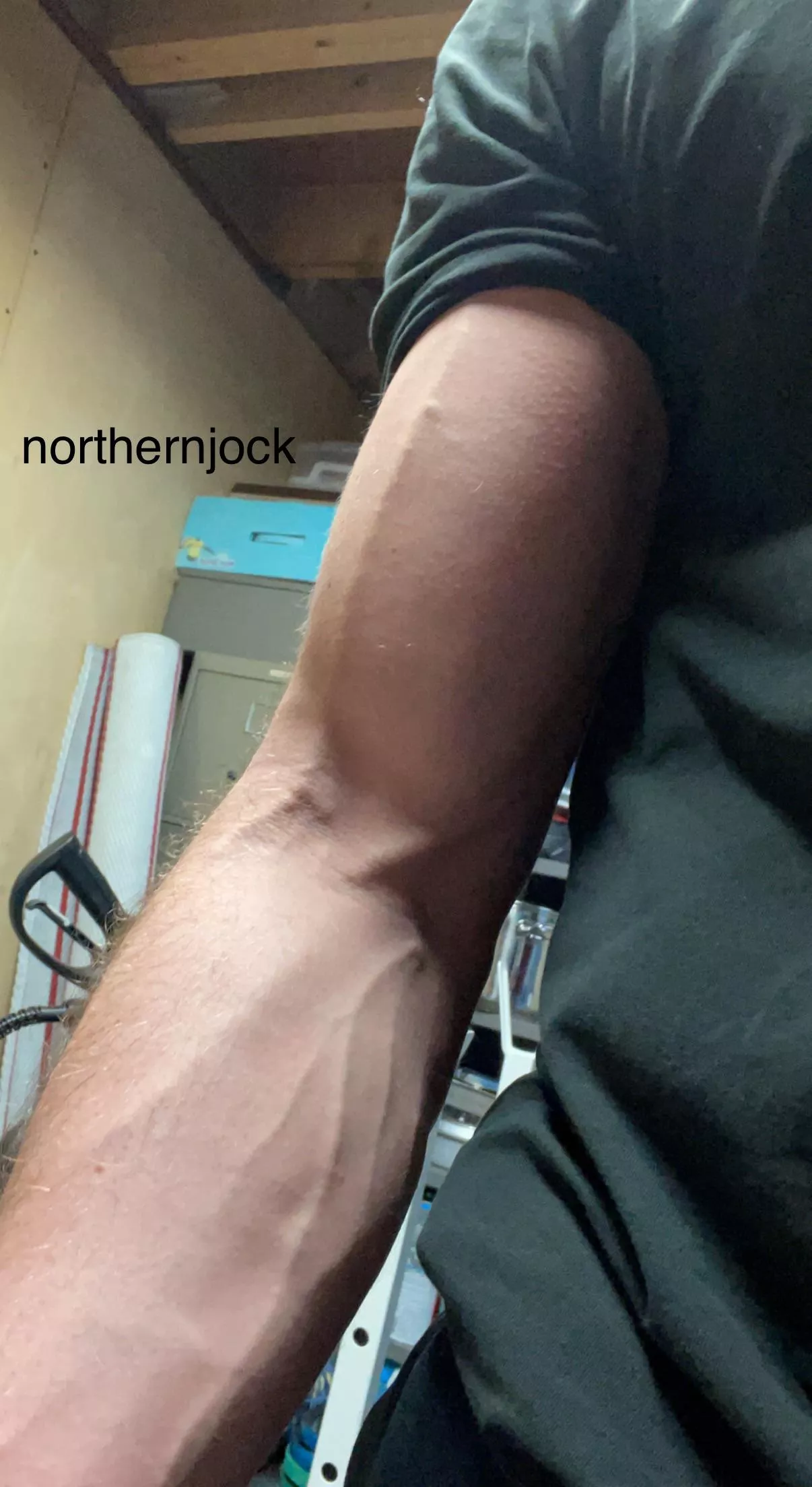 Hope you’re okay with some veins