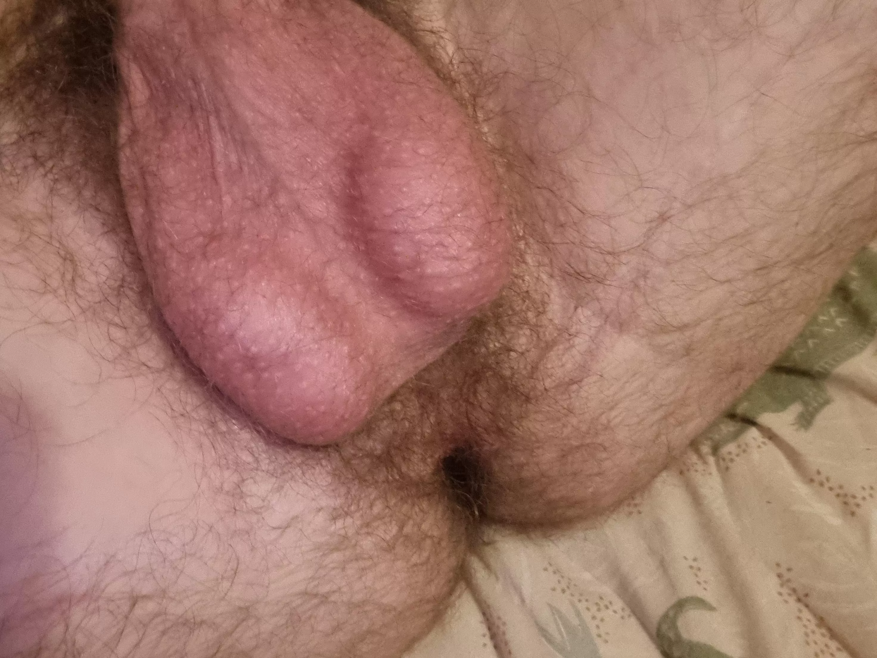 Hot Hairy Balls