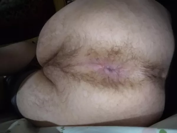 how's my hole looking?? how's my hole looking??