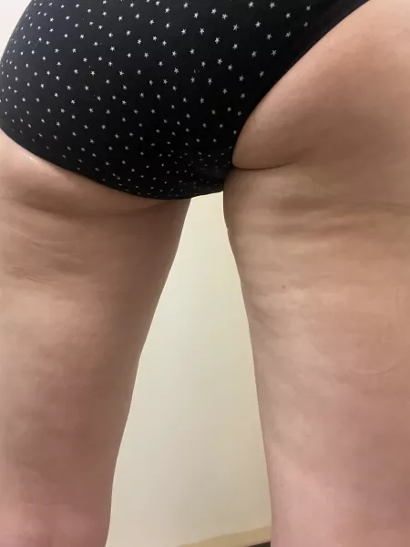 Husband Disgusted With Sexy Cellulite Husband Disgusted With Sexy Cellulite