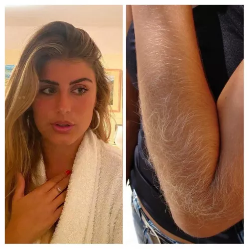 I always get teased because of my arms, are they really that hairy?? 😕