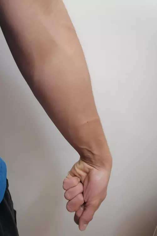 I feel like I'm lacking more scratches but I'm willing to get a second opinion I feel like I'm lacking more scratches but I'm willing to get a second opinion