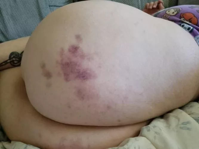 I got a bit carried away with my fwb