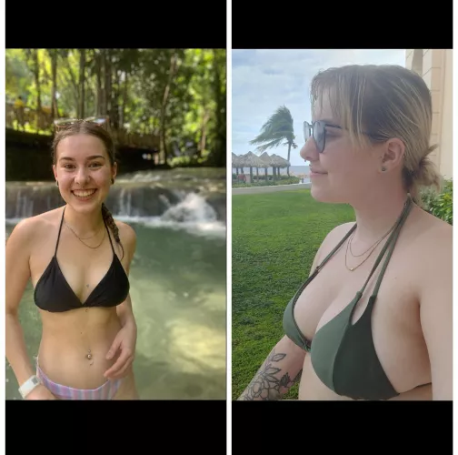 i had a breast reduction, then having a baby gave me my boobies backš