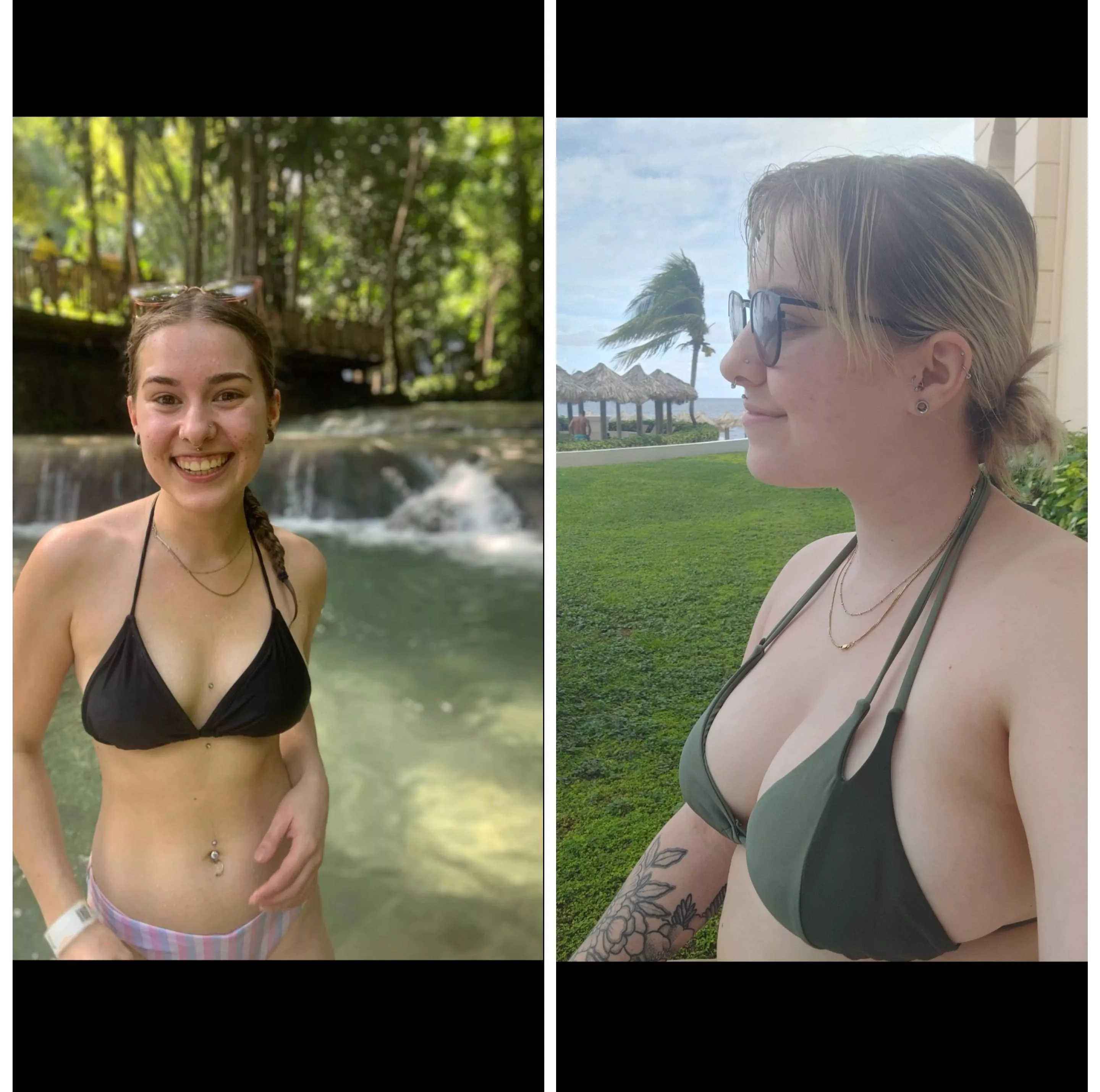 i had a breast reduction, then having a baby gave me my boobies backš i had a breast reduction, then having a baby gave me my boobies backš