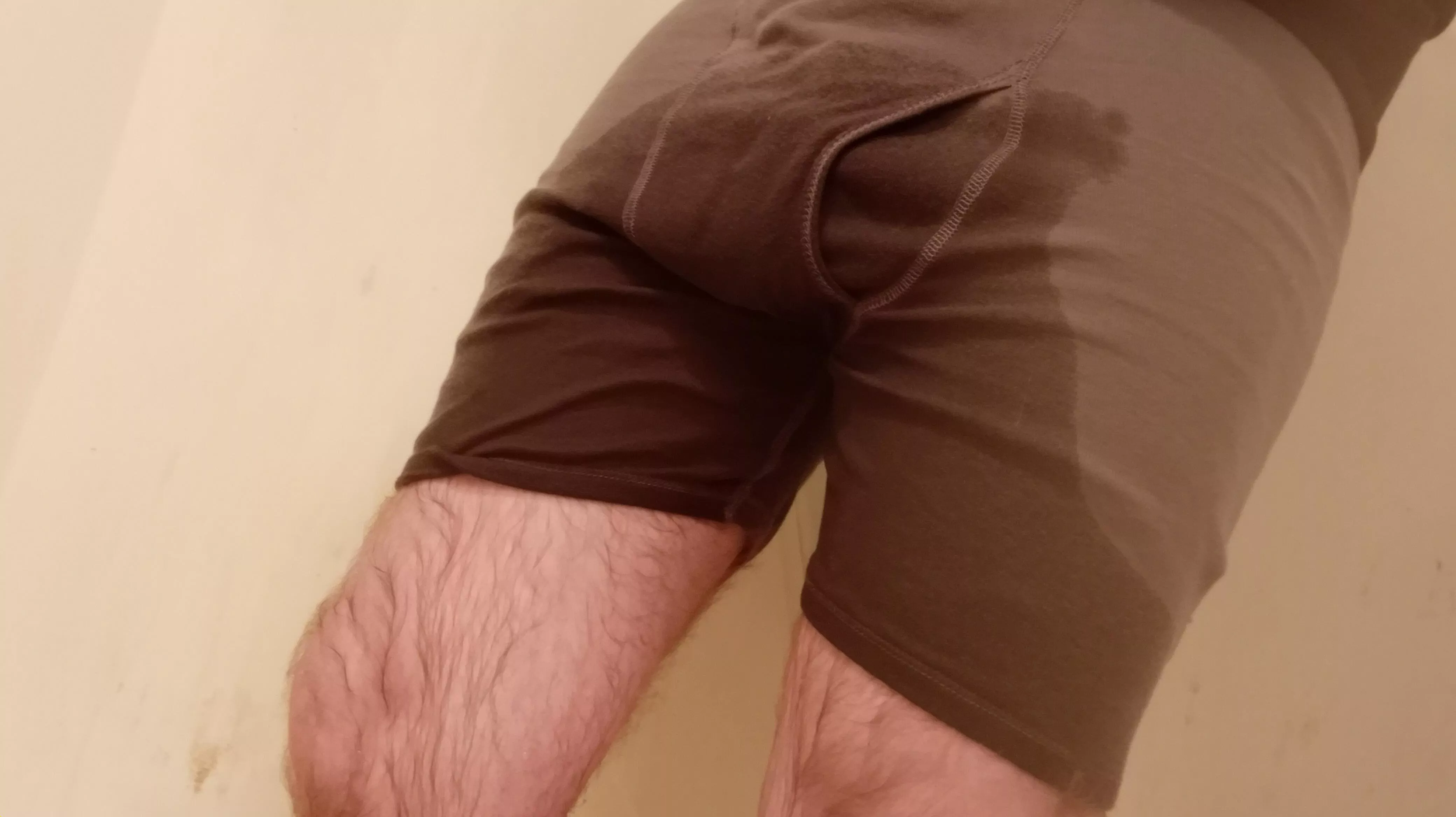 I had an accident I had an accident