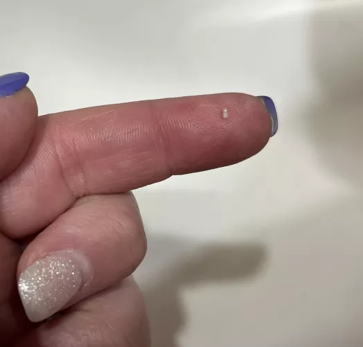 I had an itch on my thigh and scratched it, this little dude popped out. Not sure what it is.