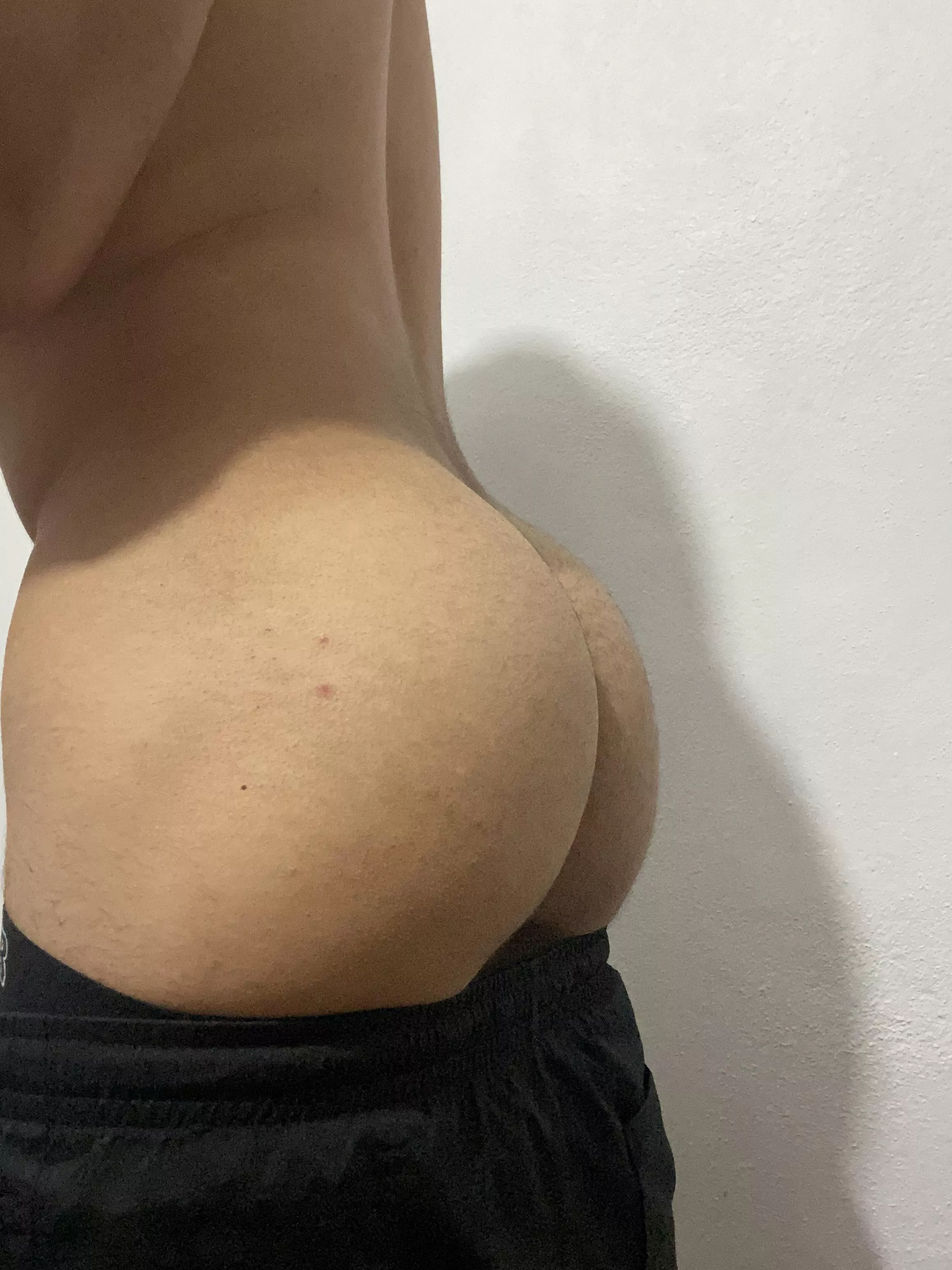 I hate those pimples 🥺 I hate those pimples 🥺