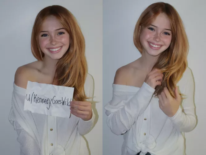 i hated my [f]reckles for most of my life but I finally learned to love them! what do u think about red hair and freckles?? (19F)