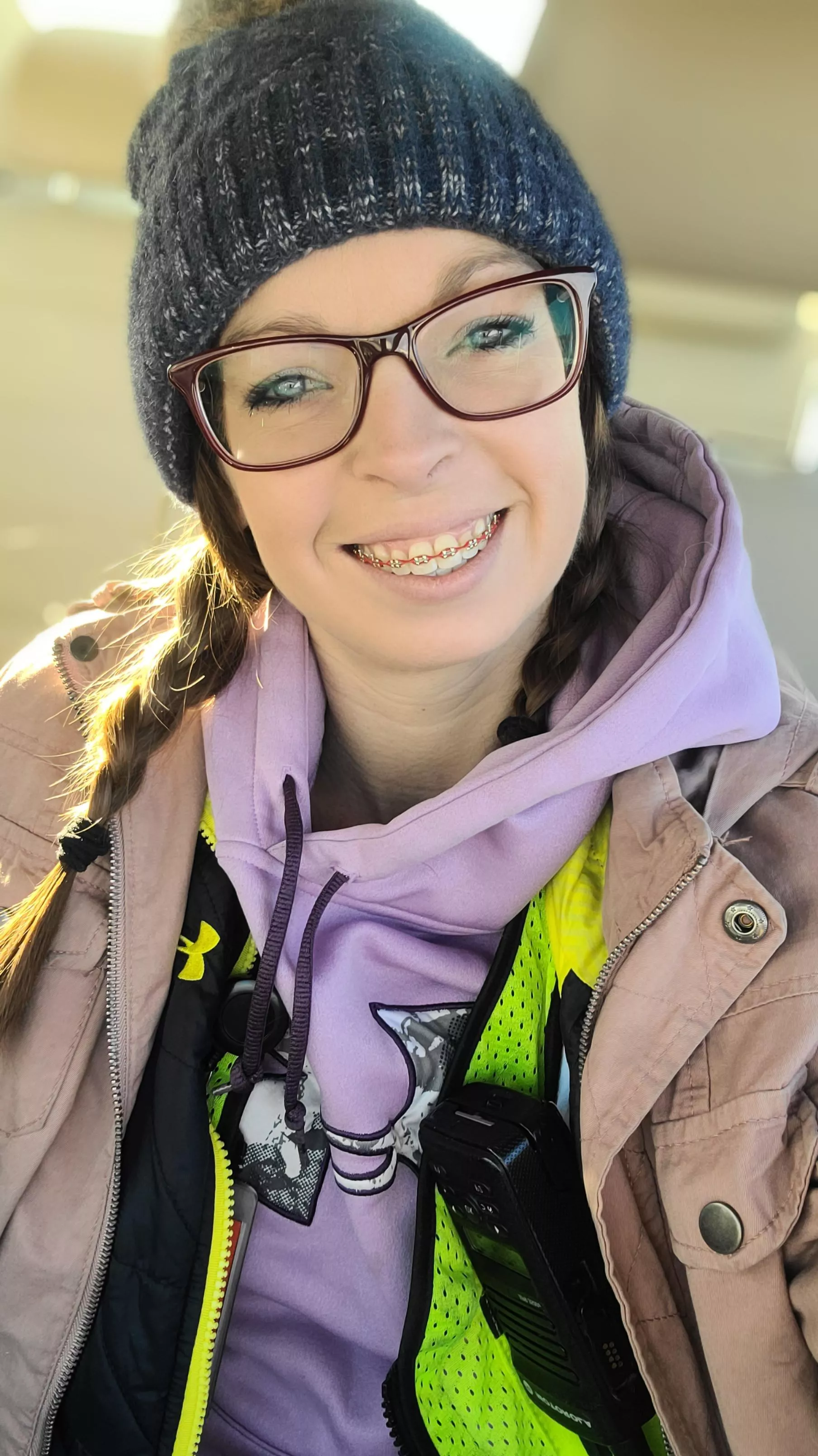 I have an adjustment tomorrow, I'll be changing the color of my bands! I'm so excited 😍