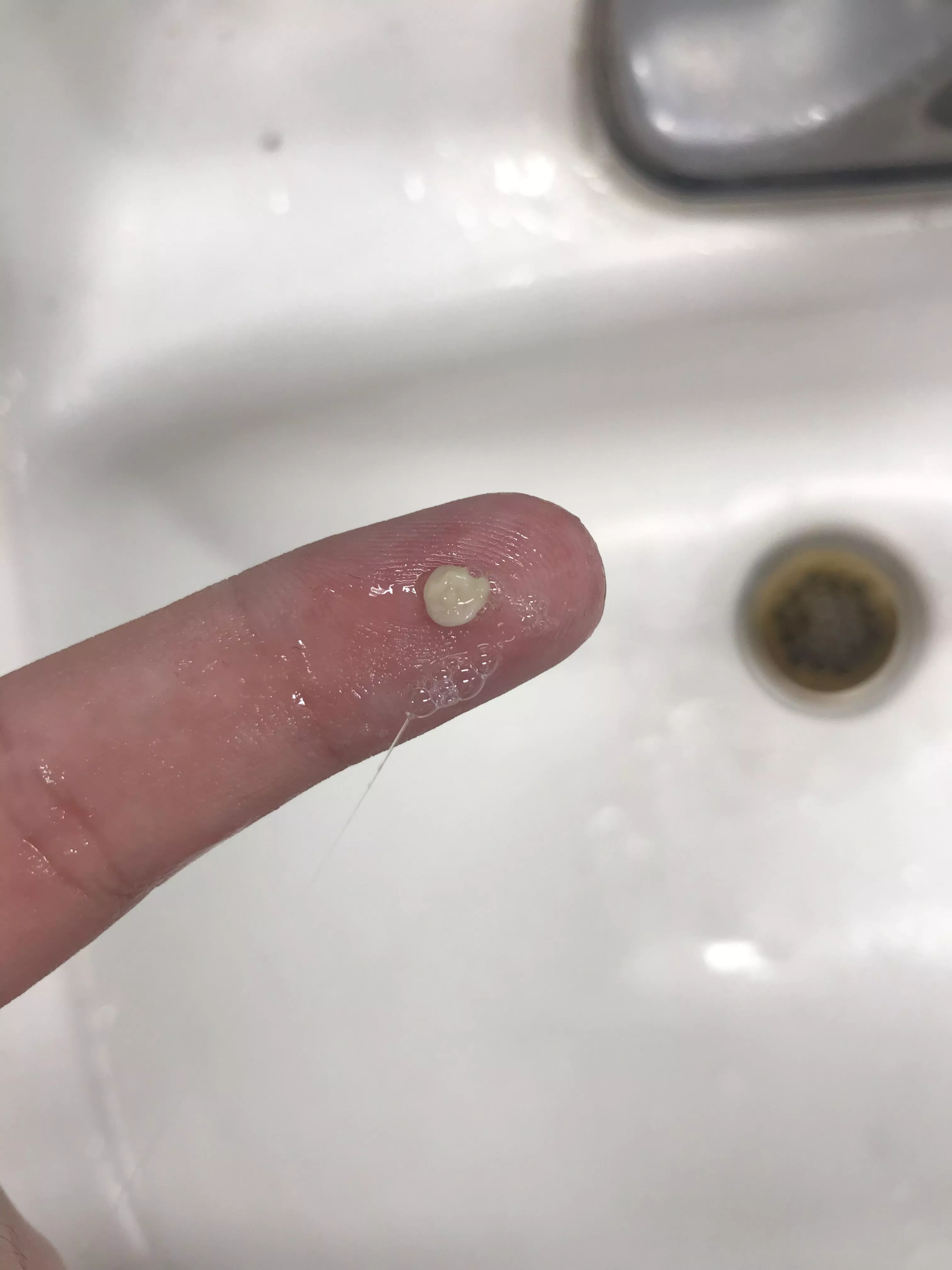 I have extremely small tonsils, to the point the ENT dr thought I’d had them removed. Combined with an overly sensitive gag reflex, I’ve never been able to remove the stones, just suffer through them. Tonight I finally got one out!