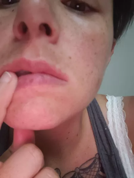 I have freckles on both my π