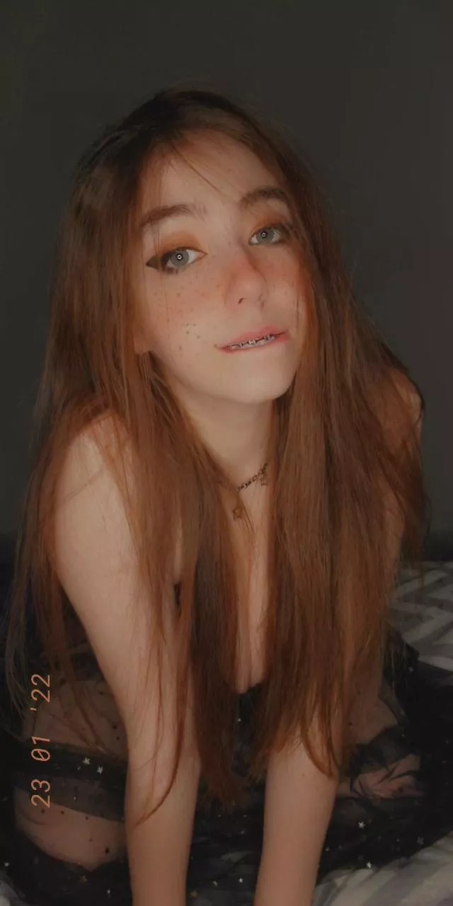 I hope you guys are having a fantastic Tuesday about to play some league but enjoy a decent braces pic 🙃🙂