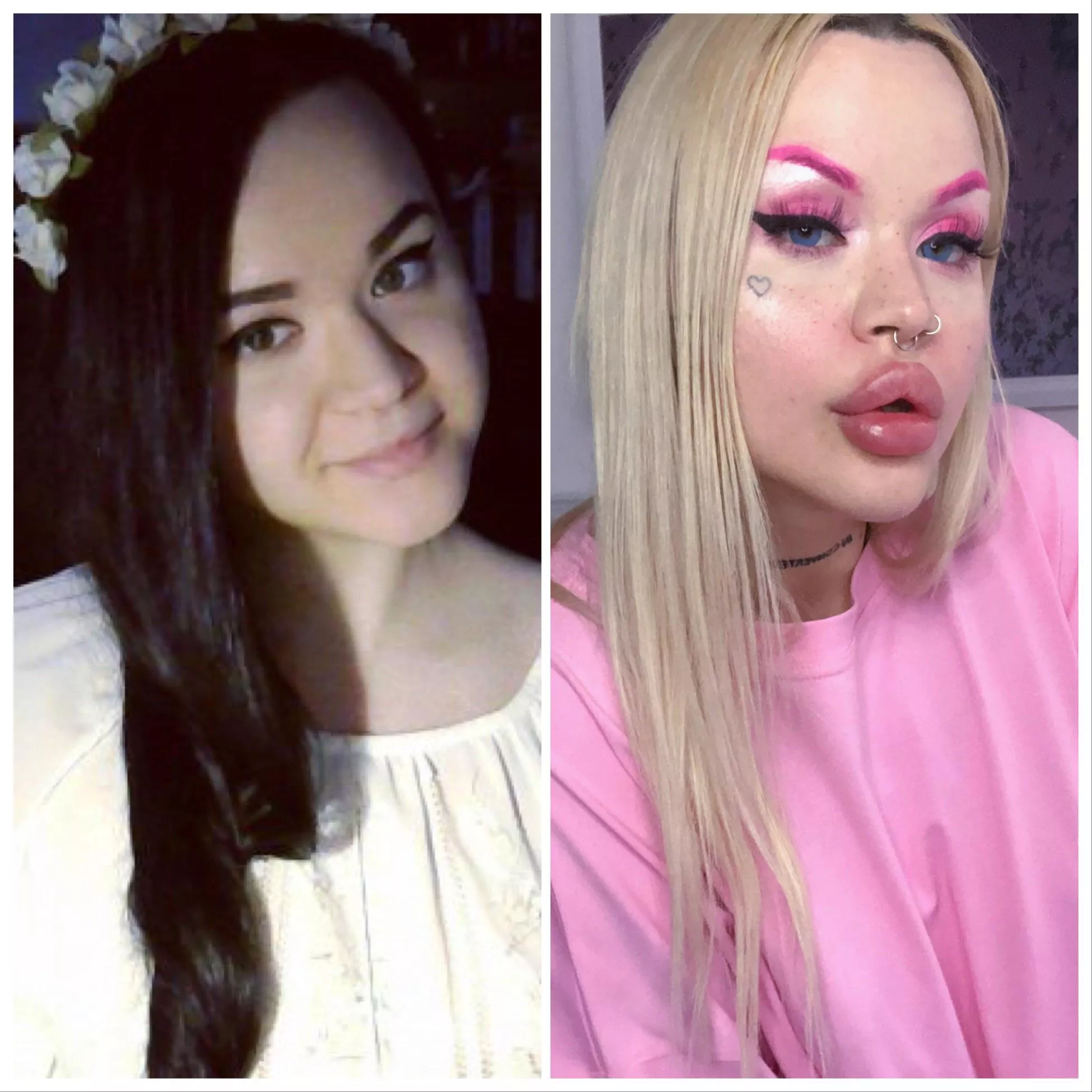 I just follow my own beauty standards ✨ My first surgery is booked on August 17th, i will finally get plastic tits! 450-500 cc! Im so happy 🥰