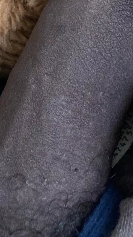 I just want to know if I’m ok why is my dick so black do that mean anything I just want to know if I’m ok why is my dick so black do that mean anything