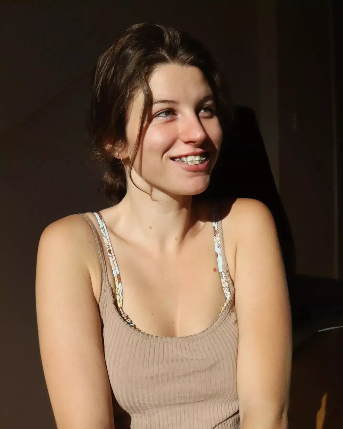 I love that you love braces x