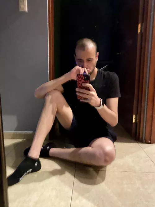 i recently got a hair transplant and i was scared to post pictures… but i’m trying to let my fears go and post pictures!