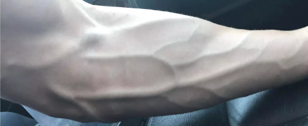 I repeat, this is NOT a dickpic I repeat, this is NOT a dickpic