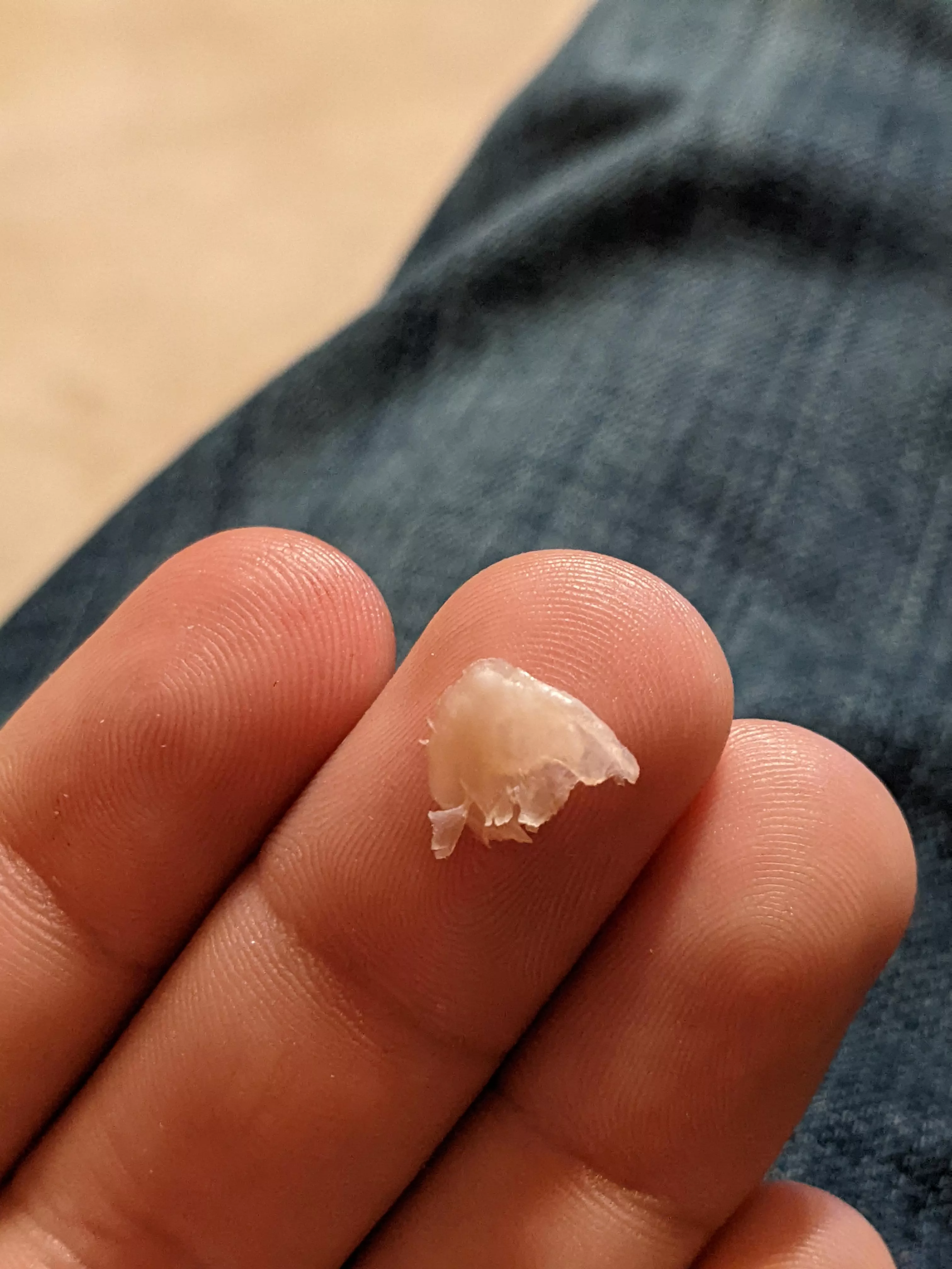 I think this is allowed: manage to cut out an ingrown toenail on my big toe. Cleaned up the blood so it's not as gross. Toe is cleaned/bandaged.