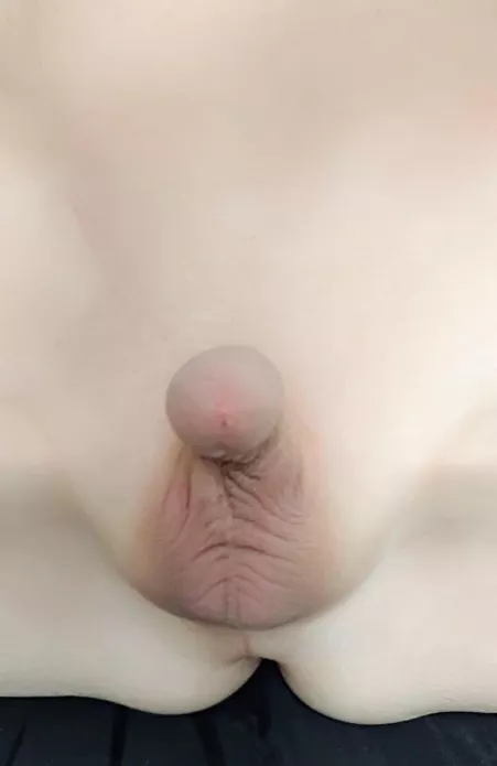 Ignoredbyall [54] Like & Share 😊