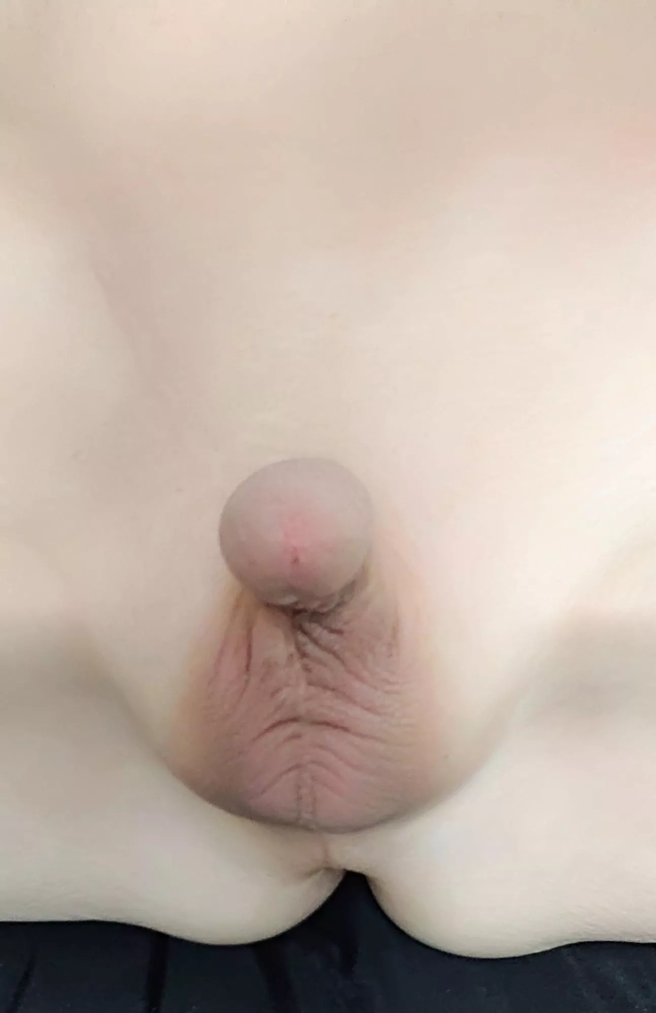 Ignoredbyall [54] Like & Share 😊