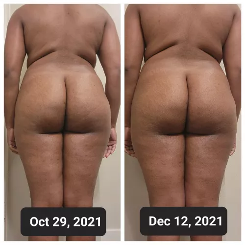 I'll soon have a roll all the way across my back!