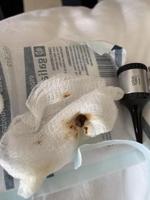 In a resort hospital with an ear infection. I wish y’all could’ve seen it.