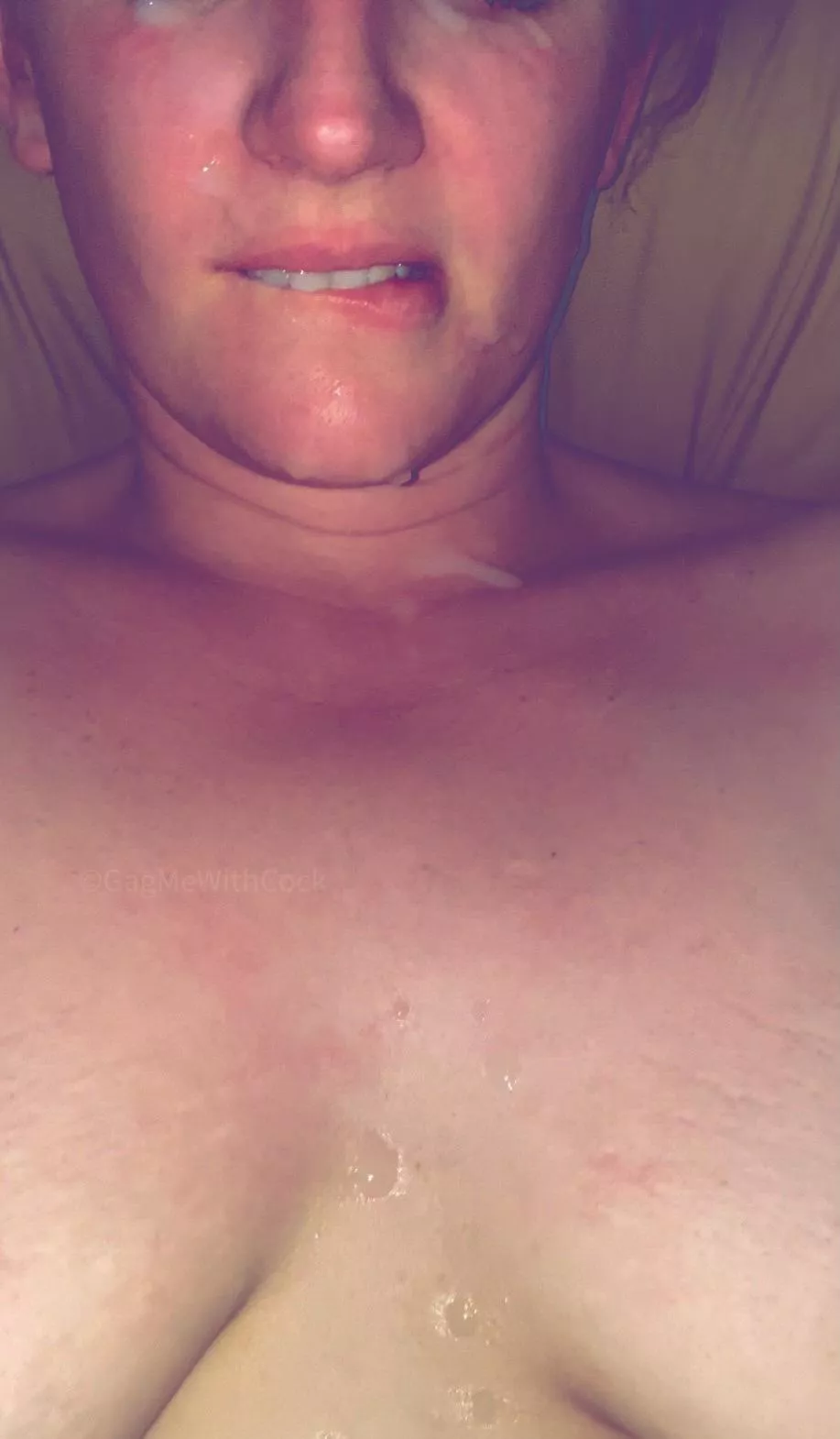 In both eyes.. In both eyes..