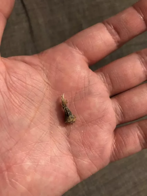 Interesting Umbolith/Navel Plug