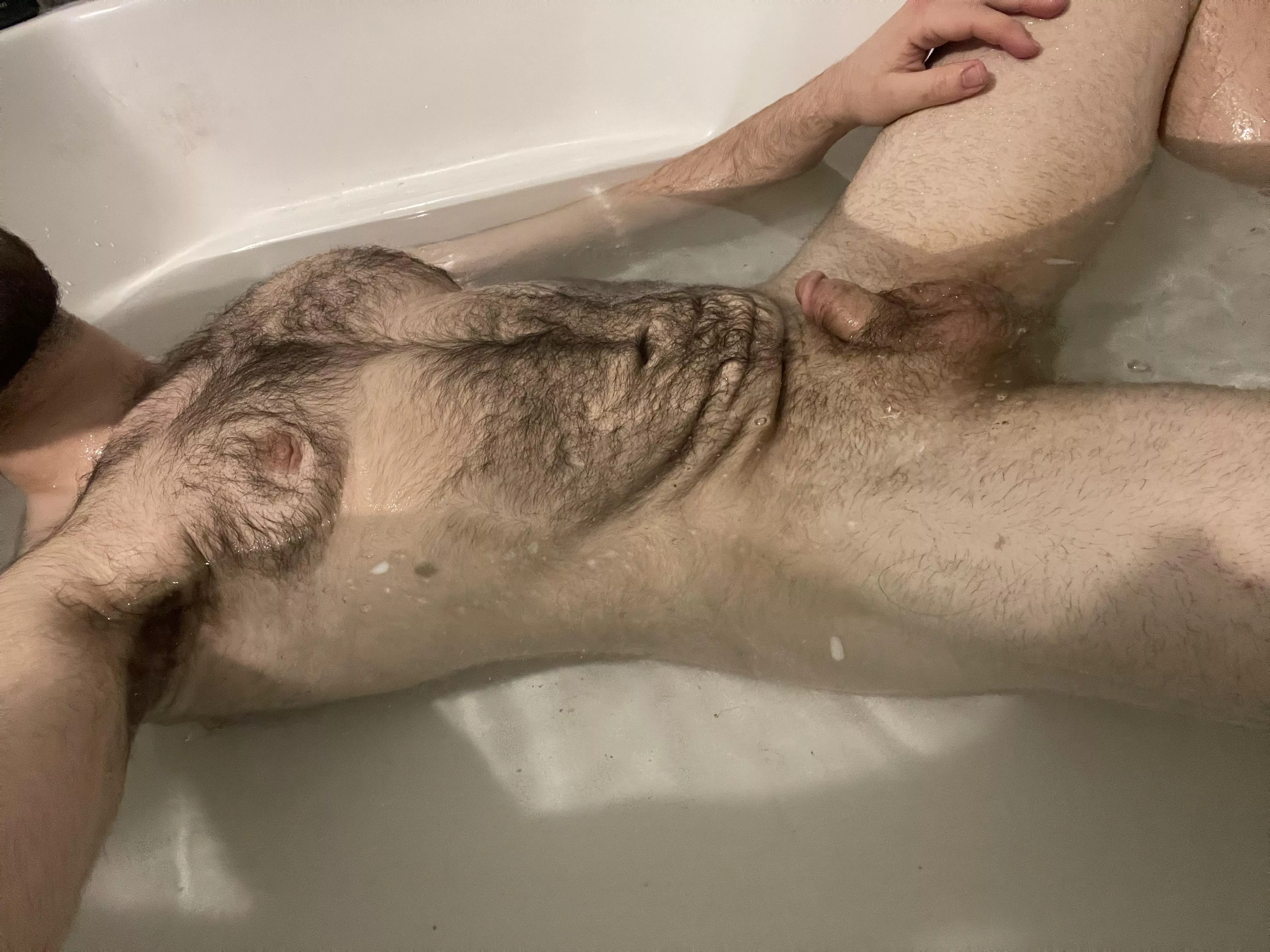 Is loose skin welcome here? Is loose skin welcome here?