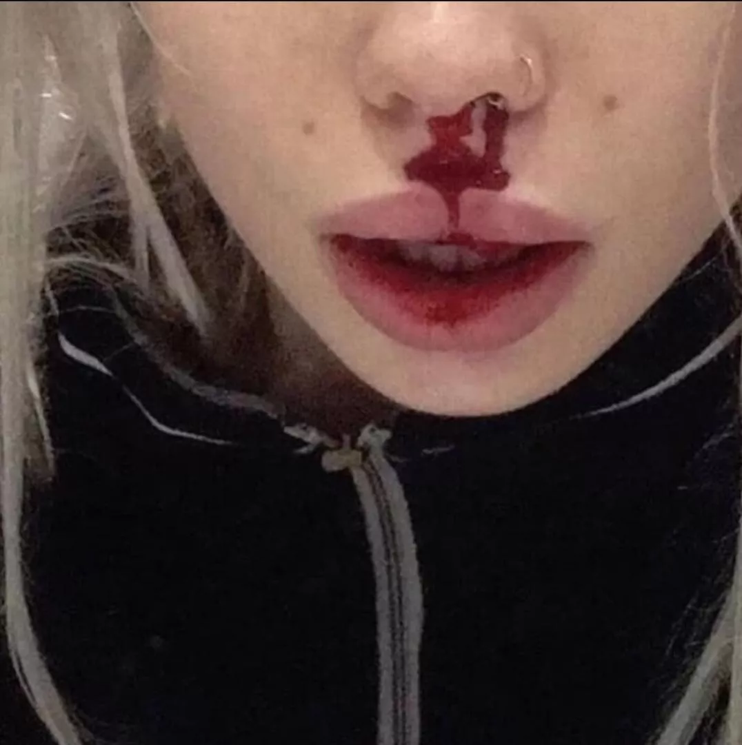 is there a fetish or a subreddit for hot girls bleeding or being a bit hurt?