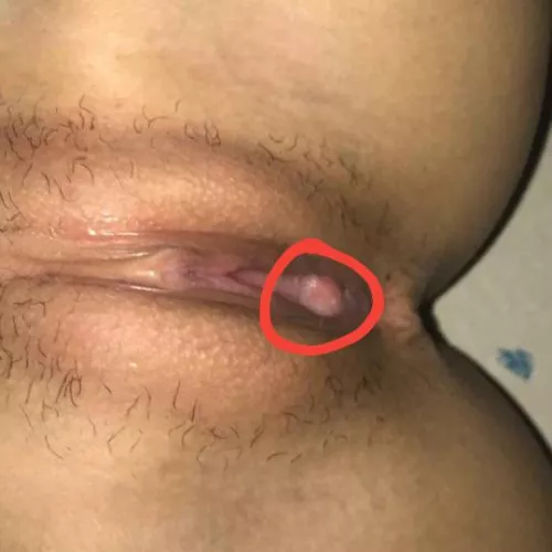 Is this something is should be concerned of? Please help Is this something is should be concerned of? Please help