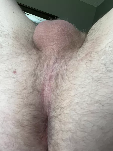 Itβs hairy