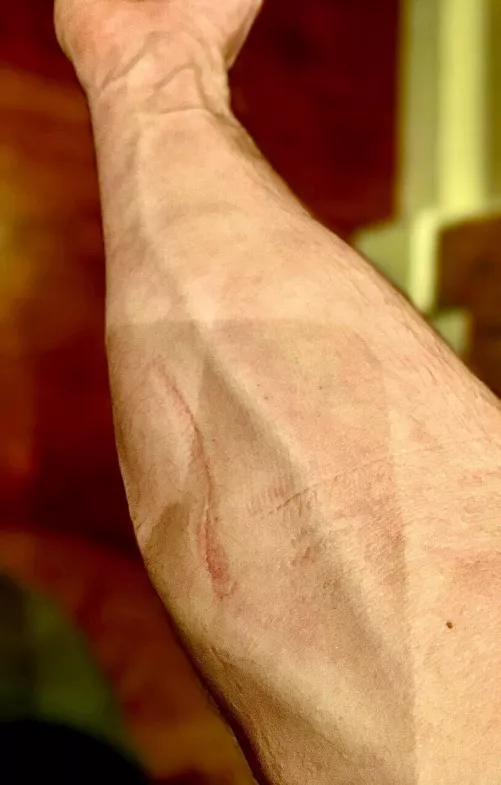 It’s not a scar. Just creases… It’s not a scar. Just creases…